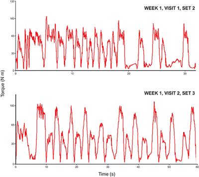 <mark class="highlighted">Eccentric Exercise</mark> Program Design: A Periodization Model for Rehabilitation Applications